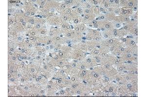 Immunohistochemical staining of paraffin-embedded liver tissue using anti-HSD17B10 mouse monoclonal antibody. (HSD17B10 antibody)