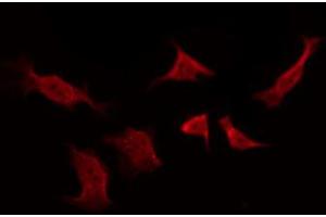 ABIN6267260 staining SK-OV3 by IF/ICC. (EGFR antibody  (pTyr1016))