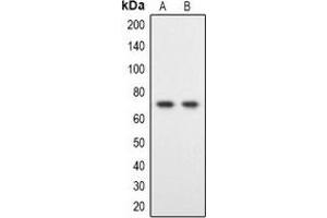 Western blot analysis of DYRK1B expression in Hela (A), HT1080 (B) whole cell lysates. (DYRK1B antibody)