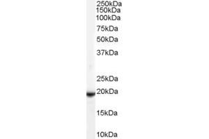 Western Blotting (WB) image for anti-Cadherin 8 (CDH8) (N-Term) antibody (ABIN2782141) (Cadherin 8 antibody  (N-Term))