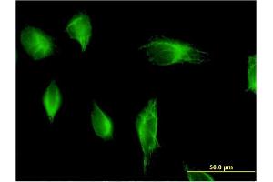 Immunofluorescence of monoclonal antibody to PIK3C2A on HeLa cell. (PIK3C2A antibody  (AA 1577-1686))
