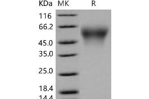 Western Blotting (WB) image for Carboxylesterase 2E (CES2E) (Active) protein (His tag) (ABIN7194593) (Carboxylesterase 2E (CES2E) (Active) protein (His tag))