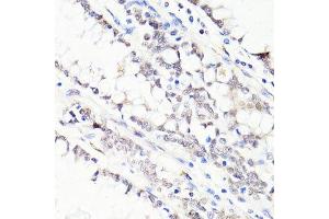 Immunohistochemistry of paraffin-embedded human colon using FKBP5 antibody. (FKBP5 antibody  (AA 308-457))