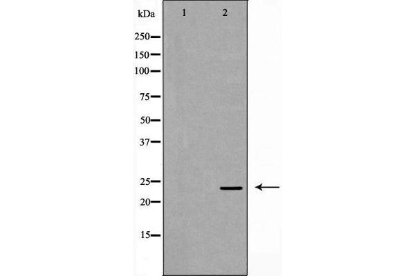 Ephrin A1 antibody  (Internal Region)