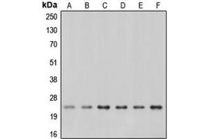 Western blot analysis of Caveolin 1 expression in A549 (A), A431 (B), NIH3T3 (C), mouse kidney (D), rat kidney (E), rat heart (F) whole cell lysates.