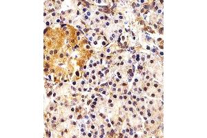 Immunohistochemical analysis of paraffin-embedded H. (ING4 antibody  (C-Term))