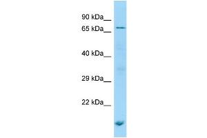 WB Suggested Anti-POF1B Antibody Titration: 1.