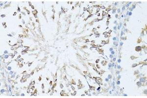 Immunohistochemistry (Paraffin-embedded Sections) (IHC (p)) image for anti-Transcription Elongation Factor, Mitochondrial (TEFM) antibody (ABIN7264563)