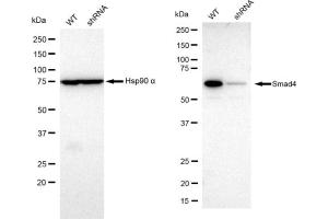 Western blotting analysis using Smad4 antibody (ABIN7800363).