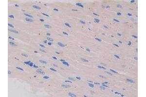 Used in DAB staining on fromalin fixed paraffin- embedded testis tissue (IL13 Receptor alpha 1 antibody  (AA 201-360))
