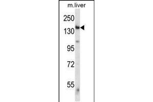 Western blot analysis in mouse liver tissue lysates (35ug/lane). (GCN2 antibody  (C-Term))