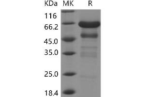 Western Blotting (WB) image for Insulin-Like Growth Factor Binding Protein 2, 36kDa (IGFBP2) protein (Fc Tag) (ABIN7196214) (IGFBP2 Protein (Fc Tag))