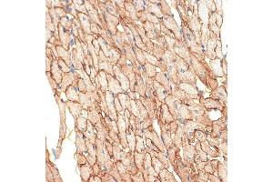 Immunohistochemistry of paraffin-embedded rat heart using Caveolin-3 Rabbit mAb (ABIN7266157) at dilution of 1:100 (40x lens). (Caveolin 3 antibody)