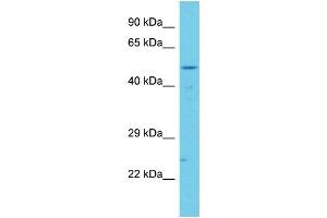 Host: Rabbit Target Name: CCDC41 Sample Type: Jurkat Whole Cell lysates Antibody Dilution: 1. (CCDC41 antibody  (C-Term))