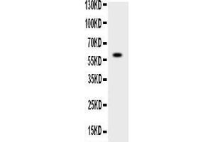 Western blot analysis of ADAMTS4 using anti-ADAMTS4 antibody .