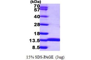 SDS-PAGE (SDS) image for Acylphosphatase 1, Erythrocyte (Common) Type (Acyp1) (AA 1-99) protein (His tag) (ABIN667361)