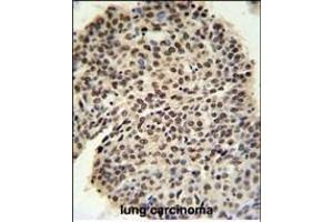 Immunohistochemistry (Paraffin-embedded Sections) (IHC (p)) image for anti-Pre-mRNA Processing Factor 19 (PRPF19) (AA 4-33), (N-Term) antibody (ABIN651064)