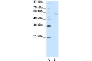 WB Suggested Anti-RCOR1 Antibody Titration:  0.