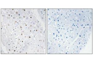 Immunohistochemical analysis of paraffin-embedded human heart tissue, using Bloom Syndrome Protein (Phospho-Thr99) antibody (left)or the same antibody preincubated with blocking peptide (right). (BLM antibody  (pThr99))