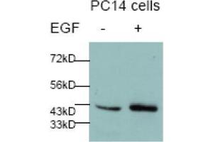 Image no. 2 for anti-Jun Proto-Oncogene (JUN) (pSer73) antibody (ABIN196612)