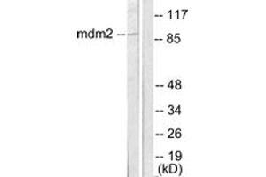 Western Blotting (WB) image for anti-Mdm2, p53 E3 Ubiquitin Protein Ligase Homolog (Mouse) (MDM2) (AA 391-440) antibody (ABIN1533341)