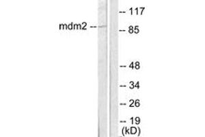 Western blot analysis of extracts from SKOV3 cells, using MDM2 Antibody. (MDM2 antibody  (AA 391-440))