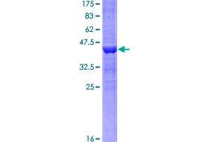 KDM5A Protein (AA 191-290) (GST tag)