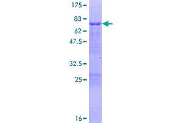 VASP Protein (AA 1-380) (GST tag)