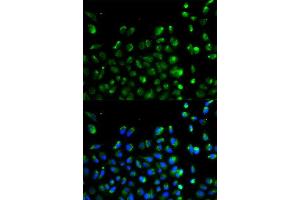 Immunofluorescence analysis of A549 cells using ATG13 antibody.