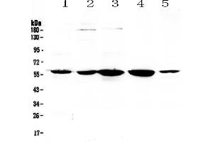 Western blot analysis of ETV6/Tel using anti-ETV6/Tel antibody .