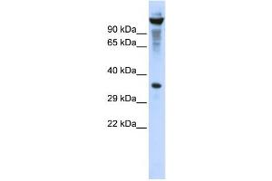 Western Blotting (WB) image for anti-Ribonuclease T2 (RNASET2) antibody (ABIN2458003) (RNASET2 antibody)