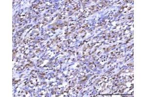 IHC analysis of RNGTT using anti-RNGTT antibody (ABIN7599723). (RNGTT antibody  (AA 11-438))
