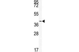 Western blot analysis of SIRT6 antibody and mouse stomach tissue lysate (SIRT6 antibody  (AA 290-319))