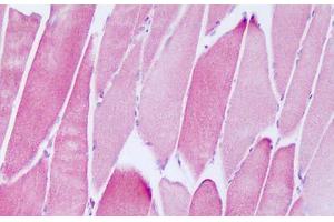 Image no. 1 for anti-NADH Dehydrogenase (Ubiquinone) 1 alpha Subcomplex, Assembly Factor 2 (NDUFAF2) (AA 22-71) antibody (ABIN6749794) (NDUFAF2 antibody  (AA 22-71))