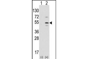 Western blot analysis of Ptf1a (arrow) using rabbit polyclonal Ptf1a Antibody (N-term) (ABIN1881703 and ABIN2839321). (PTF1A antibody  (N-Term))