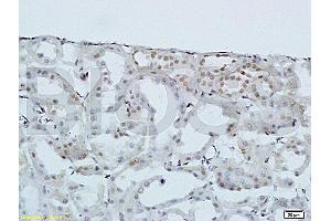 Formalin-fixed and paraffin-embedded: rat kidney tissue labeled with Rabbit Anti-HOXA10 Polyclonal Antibody (ABIN741195) , Unconjugated 1:200 followed by conjugation to the secondary antibody and DAB staining