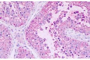 Human Testis: Formalin-Fixed, Paraffin-Embedded (FFPE) (GPR22 antibody  (C-Term))