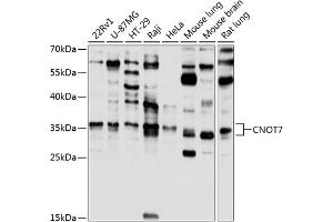 Western blot analysis of extracts of various cell lines, using CNOT7 antibody (ABIN6127563, ABIN6138783, ABIN6138784 and ABIN6224834) at 1:1000 dilution. (CNOT7 antibody  (AA 90-160))