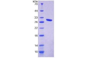 SDS-PAGE analysis of Mouse CHRNe Protein.