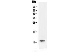 Western Blotting (WB) image for anti-Trefoil Factor 3 (Intestinal) (TFF3) (AA 23-81) antibody (ABIN5692886)