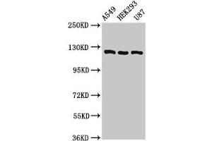 Western Blot Positive WB detected in: A549 whole cell lysate, HEK293 whole cell lysate, U87 whole cell lysate All lanes: ACLY antibody at 8 μg/mL Secondary Goat polyclonal to rabbit IgG at 1/50000 dilution Predicted band size: 121, 120, 92 kDa Observed band size: 121 kDa (ACLY antibody  (AA 4-265))