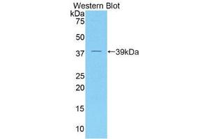 Western Blotting (WB) image for anti-Dickkopf Homolog 4 (Xenopus Laevis) (DKK4) (AA 37-141) antibody (ABIN3202023) (DKK4 antibody  (AA 37-141))