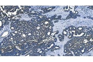 IHC analysis of PCBP2/hnRNP E2 using anti-PCBP2/hnRNP E2 antibody (ABIN7600449). (PCBP2 antibody  (AA 197-276))