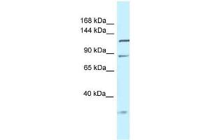 Western Blot showing Tmem132d antibody used at a concentration of 1. (TMEM132D antibody  (Middle Region))