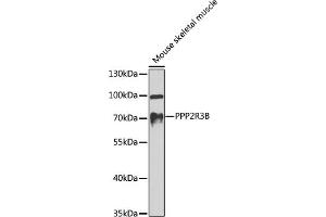 Western blot analysis of extracts of mouse skeletal muscle, using PPP2R3B antibody (ABIN6128489, ABIN6146091, ABIN6146092 and ABIN6224568) at 1:1000 dilution. (PPP2R3B antibody  (AA 356-575))