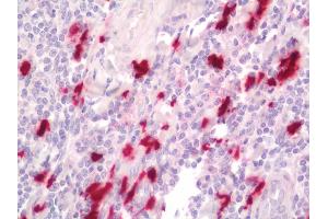Human Tonsil: Formalin-Fixed, Paraffin-Embedded (FFPE). (S100A9 antibody  (FITC))