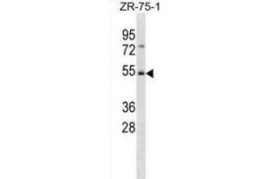 Western Blotting (WB) image for anti-F-Box and WD Repeat Domain Containing 4 (FBXW4) antibody (ABIN3001377)