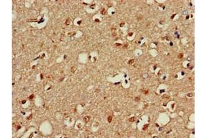 Immunohistochemistry of paraffin-embedded human brain tissue using ABIN7155835 at dilution of 1:100 (OTX1 antibody  (AA 29-244))