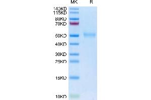 Biotinylated Human TGFBR1 on Tris-Bis PAGE under reduced condition. (TGFBR1 Protein (AA 34-125) (mFc-Avi Tag,Biotin))