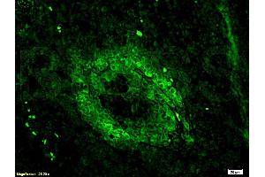 Formalin-fixed and paraffin embedded mouse lymphoma tissue labeled Anti-CD3 Polyclonal Antibody, Unconjugated (ABIN672921) 1:200, followed by conjugation to the secondary antibody Goat Anti-Rabbit IgG, FITC conjugated used at 1:200 dilution for 40 minutes at 37°C. (CD3 epsilon antibody  (AA 101-189))